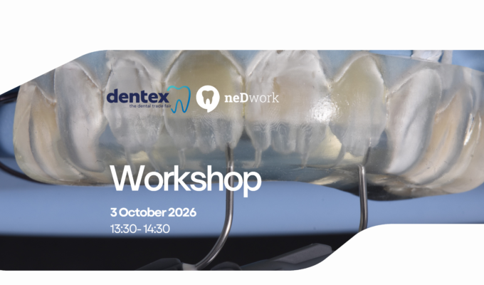 Moulding Injection Technique (MIT): Management of Tooth Wear