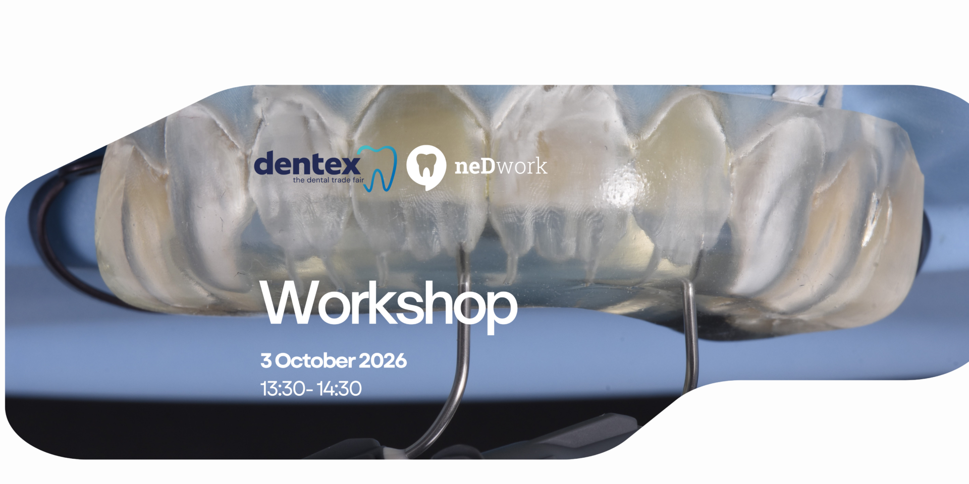 Sat Moulding Injection Technique MIT Management of Tooth Wear Dentex